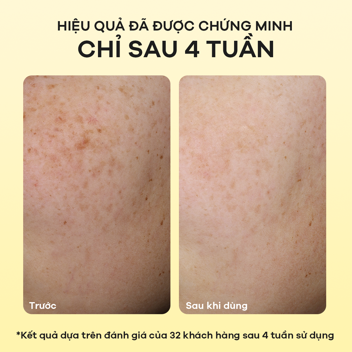 35D---POST-FB